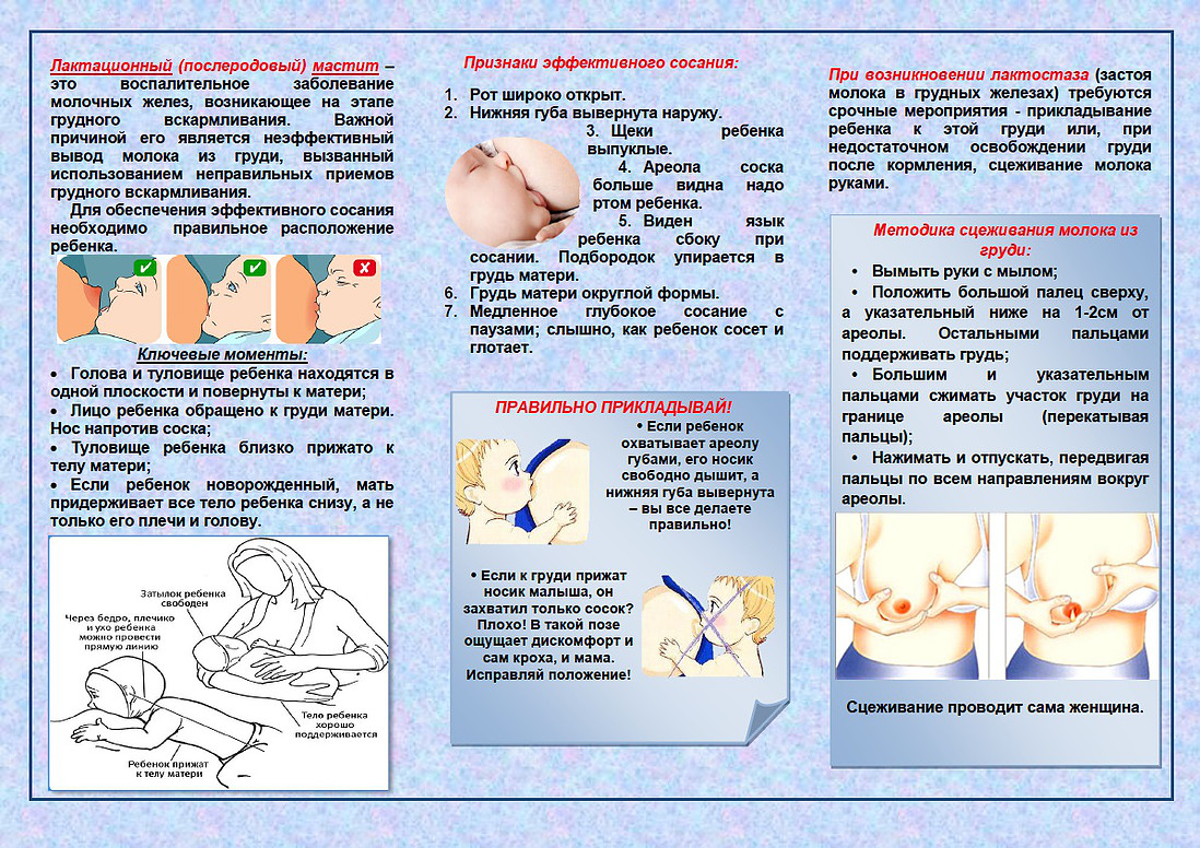 Методика сцеживания молока из груди. Recommendations breast-feeding